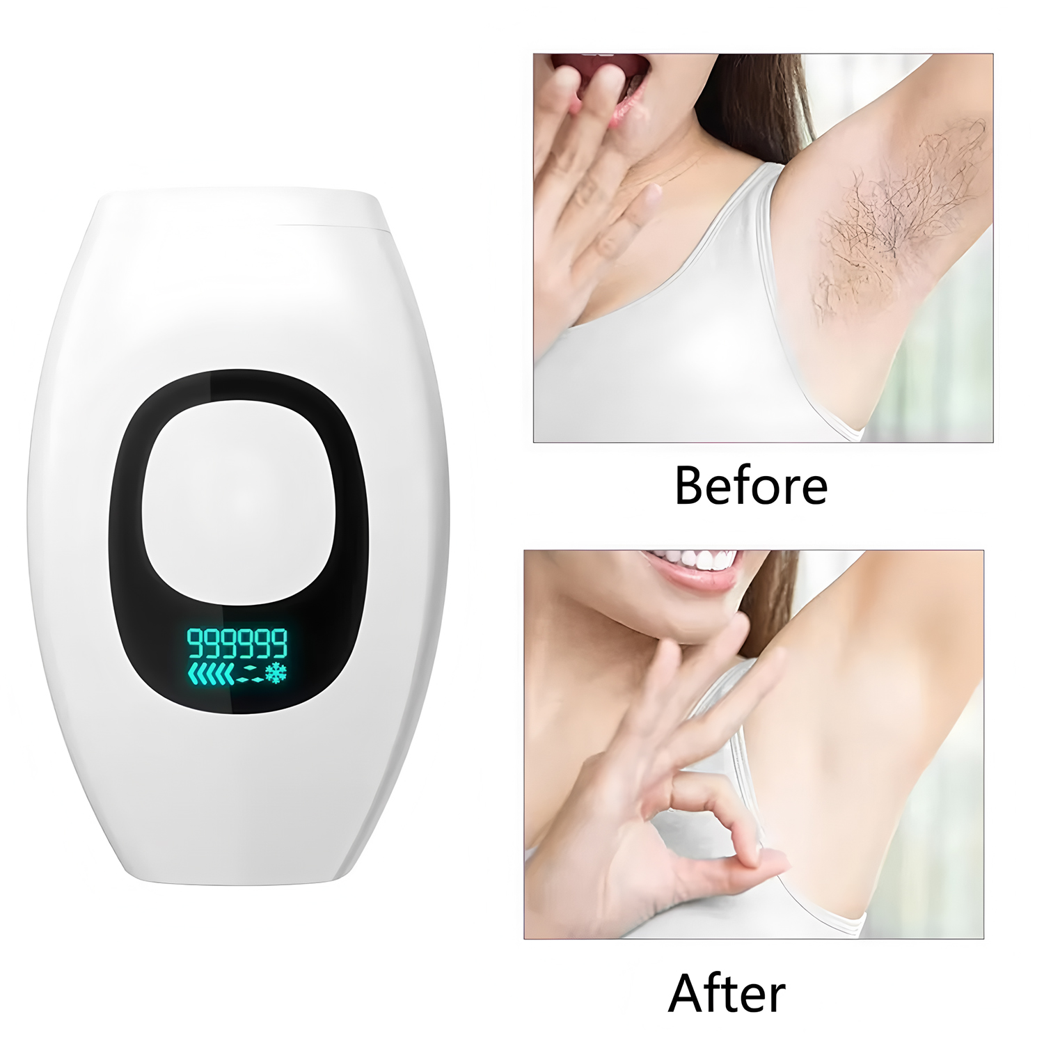 From Home Hair Care - Beauty Care IPL Haarentfernungsgerät 990.000 Blitze