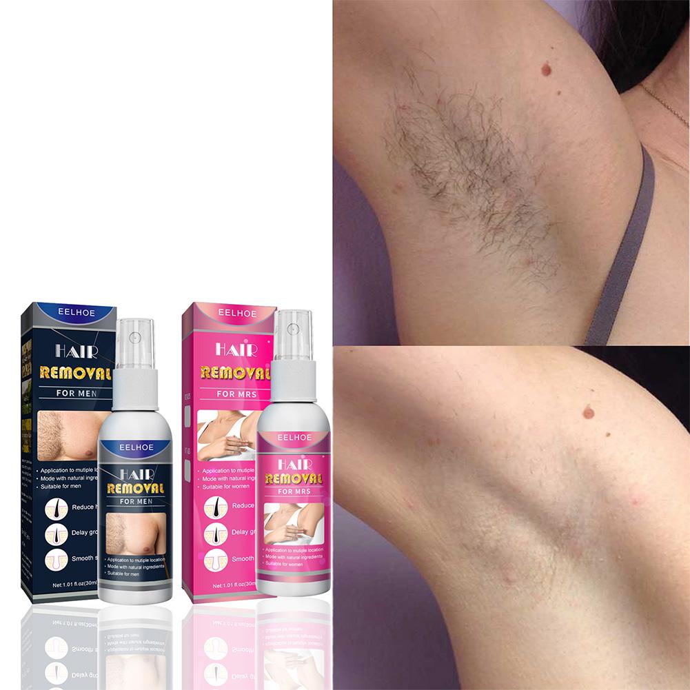 1/2PCS Super Natürliche Schmer – Hair Care China Bewertung und Preis